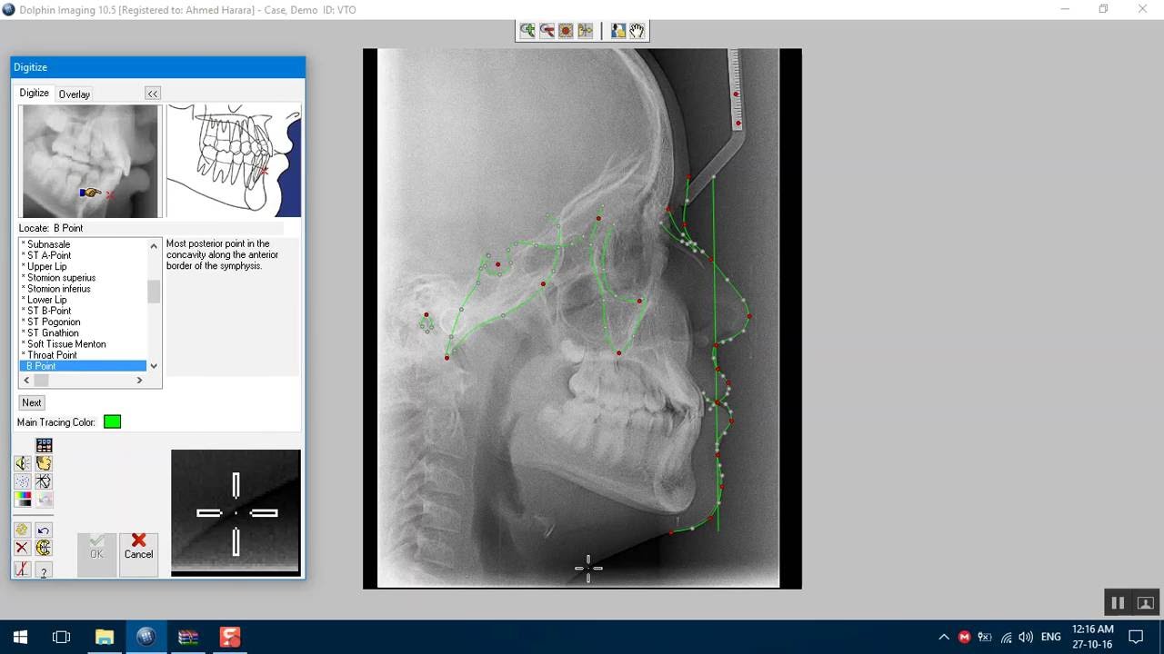 orthodontic cephalometric tracing software